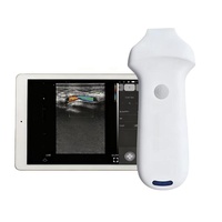 Escáner de Ultrasonido Doppler Inalámbrico Lineal Portátil Veterinario Eléctrico de 64 Canales, 192E, 16Mhz, 20Mhz