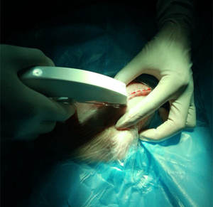 Medical <strong>Disposable</strong> <strong>Skin</strong> <strong>Stapler</strong> and Remover <strong>35W</strong> <strong>Skin</strong> <strong>Stapler</strong> for <strong>Skin</strong> Suturing Surgery - Product Image 6