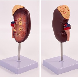 Modèle de rein humain naturel de grande taille, modèle d'anatomie du rein et de la glande surrénales, rein simulé, modèle d'organe interne pour l'enseignement. - Product Image 1