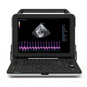 Máquina Portátil de Ultrasonido Cardíaco Veterinario Doppler Color para Hospital de Mascotas con Imágenes Doppler de Tejidos - Product Image 3