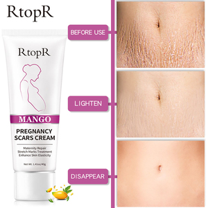Mango rimuovi cicatrici da gravidanza crema per l'acne trattamento per smagliature riparazione di maternità Anti-età Anti-Winkles rassodante creme per il corpo HH - Product Image 4