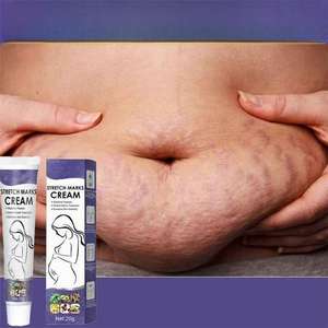 Crema Corporal para Embarazadas con Ácido Tranexámico y Arbutina que Ayuda a Mejorar la Textura y Elasticidad <span class=keywords><strong>de</strong></span> la Piel - Product Image 2