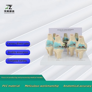 แบบจำลองข้อเข่า 4 ขั้นตอน พร้อมตัวหนีบด้านหลัง แบบจำลองข้อเข่าสำหรับการสอนศัลยกรรมกระดูก ขายตรงจากโรงงาน - Product Image 2