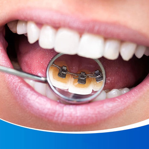 Espejo Bucal de Acero Inoxidable con Mango, Herramienta de Inspección Oral Dental, Espejo Bucal Dental Profesional, Instrumento Quirúrgico Dental - Product Image 5