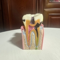 Modelo DE EDUCACIÓN anatómica para caries dental 6 demostraciones de sección transversal bilateral para estudio de ciencia médica