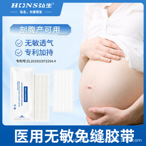 Bande adhésive médicale sans suture, hypoallergénique, respirante, pour soins des plaies, fermeture postopératoire et pansement adhésif pour sutures - Product Image 5