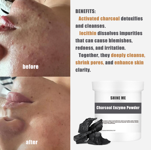 OEM ODM Etiqueta Privada cosmético SPA + carbón activo enzima papaína carbón enzima limpieza en polvo carbón en polvo precio/fabricación - Product Image 6