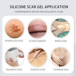 Máquina de Eliminación de <span class=keywords><strong>Cicatrices</strong></span> con Plasma Láser Mederma Advanced Scar Gel, para Curar <span class=keywords><strong>Cicatrices</strong></span> y Manchas de Acné - Product Image 5