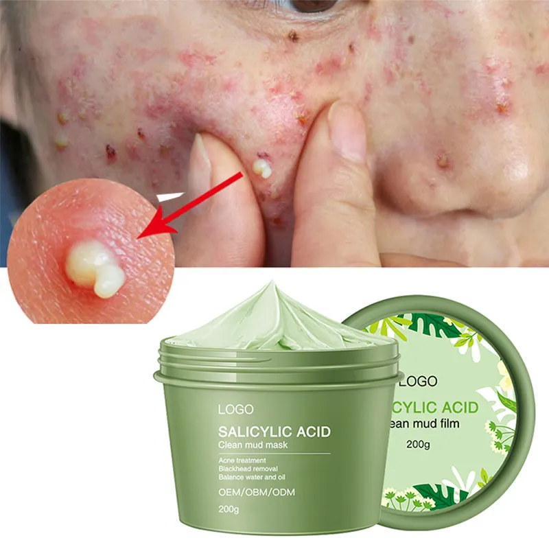 Maschera di argilla di tè verde biologico naturale purificante pulizia profonda idratante idratante rimozione di punti neri pori dell'acne