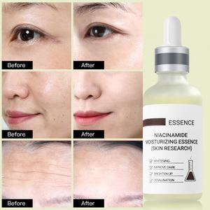 Sérum Éclaircissant Anti-Taches à Marque Blanche, Naturel, à la Niacinamide, pour l'Hyperpigmentation et l'Élimination des Taches de Rousseur, Sérum Blanchissant - Product Image 2