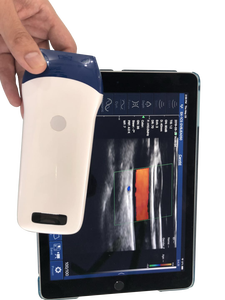 Sonda de Ultrassom Portátil Sem Fio com Array Linear, Imagem Colorida Doppler, Grau Clínico - Product Image 4