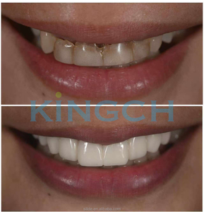 Disco de Zirconia Dental Precoloreado de Alta Resistencia 1200Mpa a <span class=keywords><strong>Precio</strong></span> de Fabricante - Product Image 4