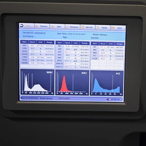 Analisador Hematológico de Sistema Aberto SK8800, Máquina de Contagem Completa de Sangue (CBC) com Diferencial de 3 Partes para Uso em Laboratório Clínico - Product Image 2