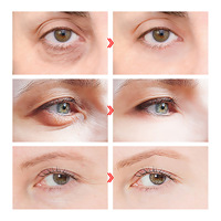 Sérum Visage Personnalisé au Logo, Hydratant Végétalien, Rétinol, Vitamine C, Raffermissant, Anti-Âge, Éclaircissant, Soin de la Peau