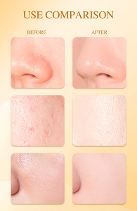 Masker Wajah Hidrogel Kecantikan Organik Korea Logo Kustom Grosir 24k <span class=keywords><strong>Gold</strong></span> bio Kolagen Lembaran Masker Perawatan Kulit Guangzhou - Product Image 5