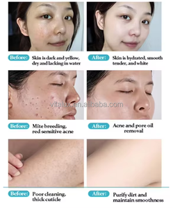 Idro dermoabrasione facciale di Mousse di idrogeno bolla 400ml di acqua soluzione di pulizia profonda liquido per la macchina di ossigeno - Product Image 6