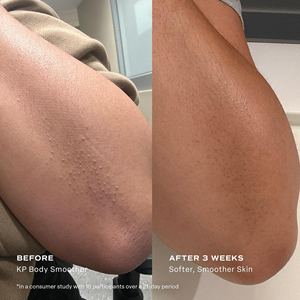 Lait Corporel Lissant Éclaircissant Végan <span class=keywords><strong>AHA</strong></span> & BHA pour Peaux Rugueuses et Irrégulières – Hydratant Exfoliant Personnalisé - Product Image 5
