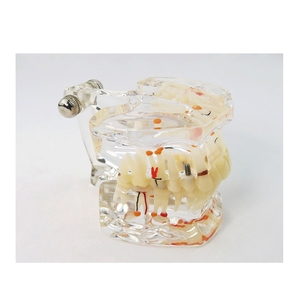 Modelo de Patología Dental con Dientes de Implante Parcial para Enseñanza - Product Image 2
