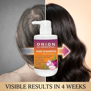 Shampooing pour la croissance des cheveux à l'oignon rouge et au romarin 400ml, shampooing naturel <span class=keywords><strong>anti</strong></span>-chute de cheveux pour cheveux fins, soin fortifiant du cuir chevelu, unisexe - Product Image 3