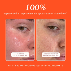 Spray de Ácido Hipocloroso de Marca Privada OEM, Reduce el Enrojecimiento, Calmante, Hidratante, Productos para el Cuidado de la <span class=keywords><strong>Piel</strong></span>, Tónico Facial en Aerosol - Product Image 4