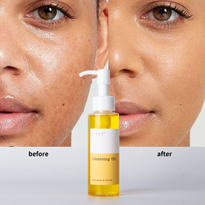 Etiqueta privada Vegano <span class=keywords><strong>Coreano</strong></span> Cuidado de la cara <span class=keywords><strong>Aceite</strong></span> de semilla de jojoba <span class=keywords><strong>Aceite</strong></span> de semilla de girasol Vitamina E <span class=keywords><strong>Aceite</strong></span> de limpieza de luz facial nutritiva - Product Image 6