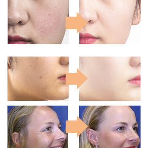 <span class=keywords><strong>Crema</strong></span> per il viso e il corpo Manuka <span class=keywords><strong>crema</strong></span> al miele Private Label di riduzione delle rughe e cicatrici - Product Image 4