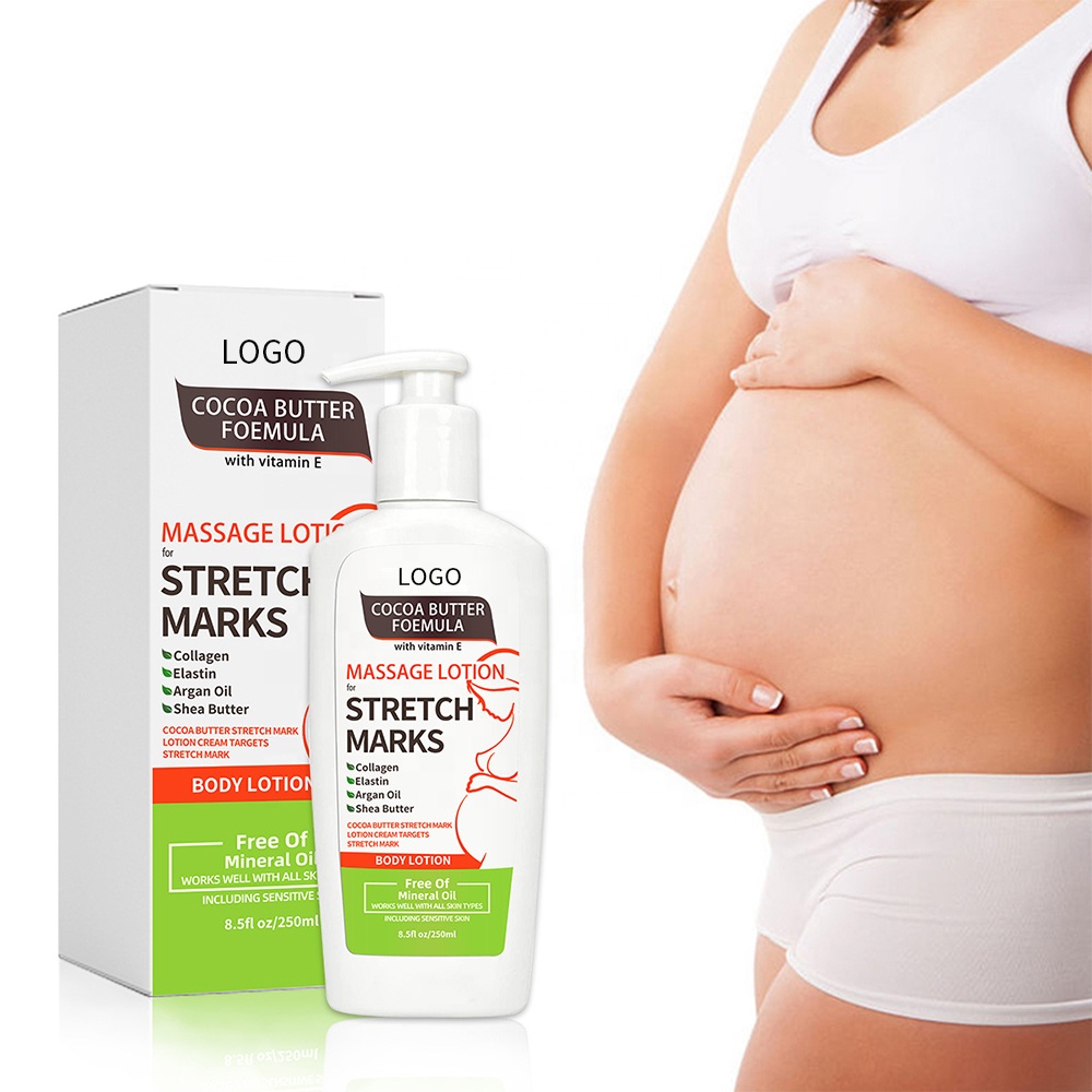 Обслуживание OEM ODM изготовленный на заказ ремонт укрепляющий крем от растяжек метка частного назначения растяжек крем для удаления