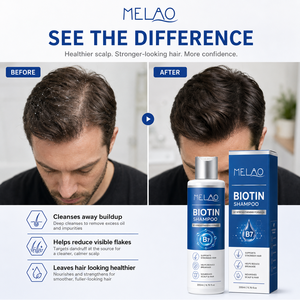 <span class=keywords><strong>Shampoo</strong></span> Vegano a Marchio Privato per la Crescita dei Capelli alla Biotina, Anticaduta e Infotiltente per Capelli Fini da <span class=keywords><strong>Uomo</strong></span> - Product Image 6