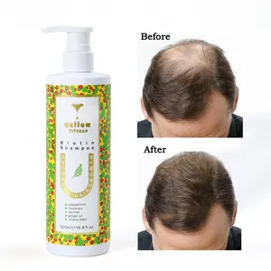 Doğal bitkisel biberiye yağı hint yağı formülü saç derisi onarım Anti saç dökülmesi saç büyüme biyotin şampuan
