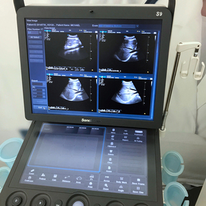 Sonosbape S9 mesin Ultrasound, alat penunjuk 4D warna portabel untuk Obstetri & kardiologi