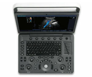 Escáner de Ultrasonido Veterinario Portátil en Blanco y Negro <span class=keywords><strong>SonoScape</strong></span> <span class=keywords><strong>E1</strong></span> <span class=keywords><strong>Vet</strong></span> para Diagnóstico de Mascotas y Ganado - Product Image 6
