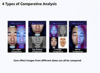 Analyseur de peau IA pour l'analyse complète du visage – Scanner et testeur cutané IA pour optimiser votre salon de beauté