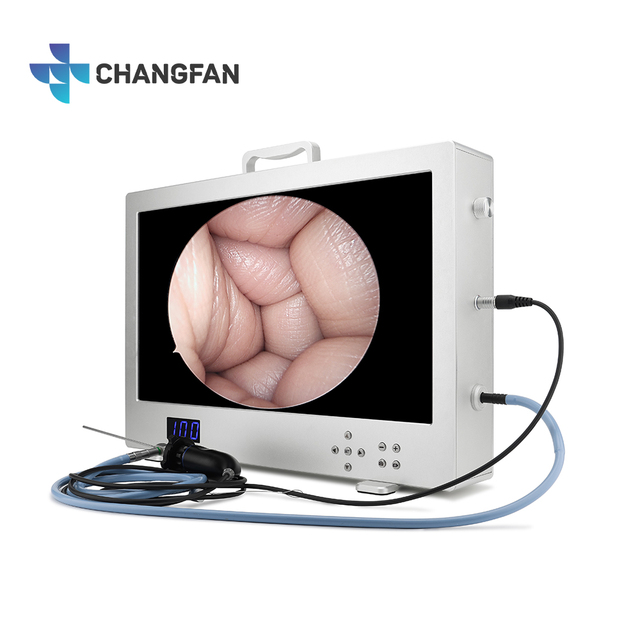 1080P Endoscope Camera System Monitor 24 Inch with Light Source All in One Endoscopic Video System for Surgery