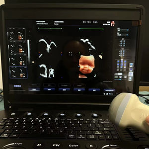 Appareils d'échographie médicale, échographie couleur 3D 4D Doppler, appareil d'échocardiographie, échographie portable pour usage humain, USG - Product Image 1