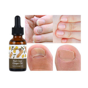 <span class=keywords><strong>Aceite</strong></span> <span class=keywords><strong>de</strong></span> jengibre para el cuidado <span class=keywords><strong>de</strong></span> las cutículas <span class=keywords><strong>de</strong></span> uñas, <span class=keywords><strong>aceite</strong></span> <span class=keywords><strong>de</strong></span> árbol <span class=keywords><strong>de</strong></span> té, productos <span class=keywords><strong>de</strong></span> reparación para el cuidado <span class=keywords><strong>de</strong></span> las uñas saludables, <span class=keywords><strong>aceite</strong></span> <span class=keywords><strong>de</strong></span> suero nutritivo para el crecimiento <span class=keywords><strong>de</strong></span> las uñas - Product Image 6