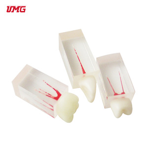 Tandheelkundige Wortel Endodontische Behandeling Tandmodel Voor Het Onderwijzen Van De Praktijk - Product Image 2