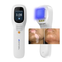 Laser Excimer LED Kernel KN-5000H 308nm UVB pour la photothérapie du vitiligo et du psoriasis