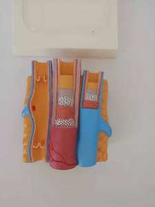 Clips articulaires d'anatomie, modèle DVT, veston des veines profondes, ondulées, modèle - Product Image 3