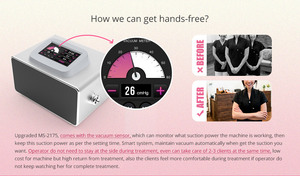 Haute promotion en gros bout à bout élargissement du sein thérapie sous vide ventouses agrandissement du sein corps sculptant la Machine - Product Image 3