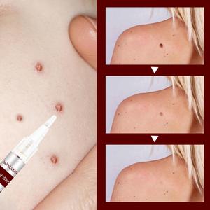 Jaysuing Venta al por Mayor Marca Privada <span class=keywords><strong>Líquido</strong></span> Quita <span class=keywords><strong>Verrugas</strong></span> y Manchas Cutáneas 3ml - Product Image 6