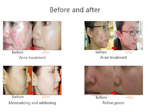 Band New Upgrade 10 in 1 Facial Hydration <b>Machine</b> -carving Facial Cleansing Skin Rejuvenation <b>Machine</b> - Product Image 6