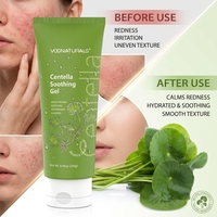 OEM ODM Centella Asiatica Gel Apaisant Hydratant Anti-acné Calme et restaure la Peau Grasse Hydratant