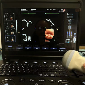 Escáner de Ultrasonido Doppler Color 3D/4D/<span class=keywords><strong>5D</strong></span> para Laptop, Obstetricia/Ginecología, Equipo de Ecografía Portátil Cardiovascular Humano - Product Image 1