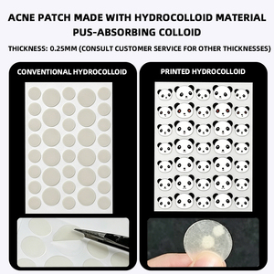AUSLKA Beauty Patch anti-acné hydrocolloï<span class=keywords><strong>de</strong></span> invisible avec motif <span class=keywords><strong>de</strong></span> dessin animé mignon et personnalisation du logo - Product Image 3