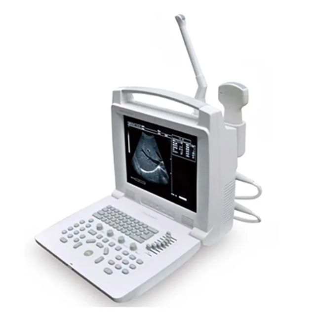 Hot Sale Digital Ultrasound System Medical Portable Ultrasound Scanner B/W Ultrasound Scanner