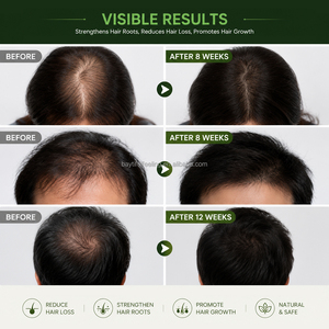 Champú Capilar Koloryst Ginseng con Extracto de Ginseng para Cabello Frágil, Alivio del Cuero Cabelludo y Anticaída, Disponible en Stock - Product Image 4