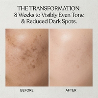 Sérum à la niacinamide Lance, marque privée, réduit la pigmentation, unifie le teint, acide tranexamique TXA, sérum anti-taches brunes