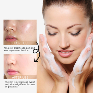 Sữa rửa mặt tẩy trang dịu nhẹ, pH thấp, chứa amino acid, làm sạch sâu, chất làm sạch mặt axit yếu, dùng hàng ngày cho chăm sóc da - Product Image 4