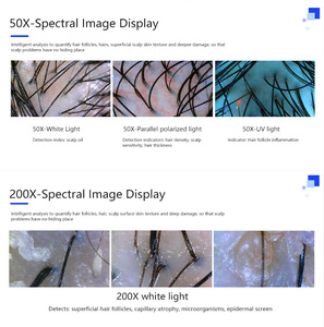 Máquina de Análisis de Cuero Cabelludo y Piel con IA Popular en 2026, con Material ABS para Uso en Centros de Belleza, Hogar y Clínicas - Product Image 5