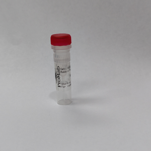 Anticuerpo Monoclonal Promabio para la Actina Alfa de Músculo Liso, Modelo 20033, Origen CN - Product Image 1